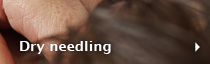 Dry needling