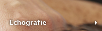 Echografie
