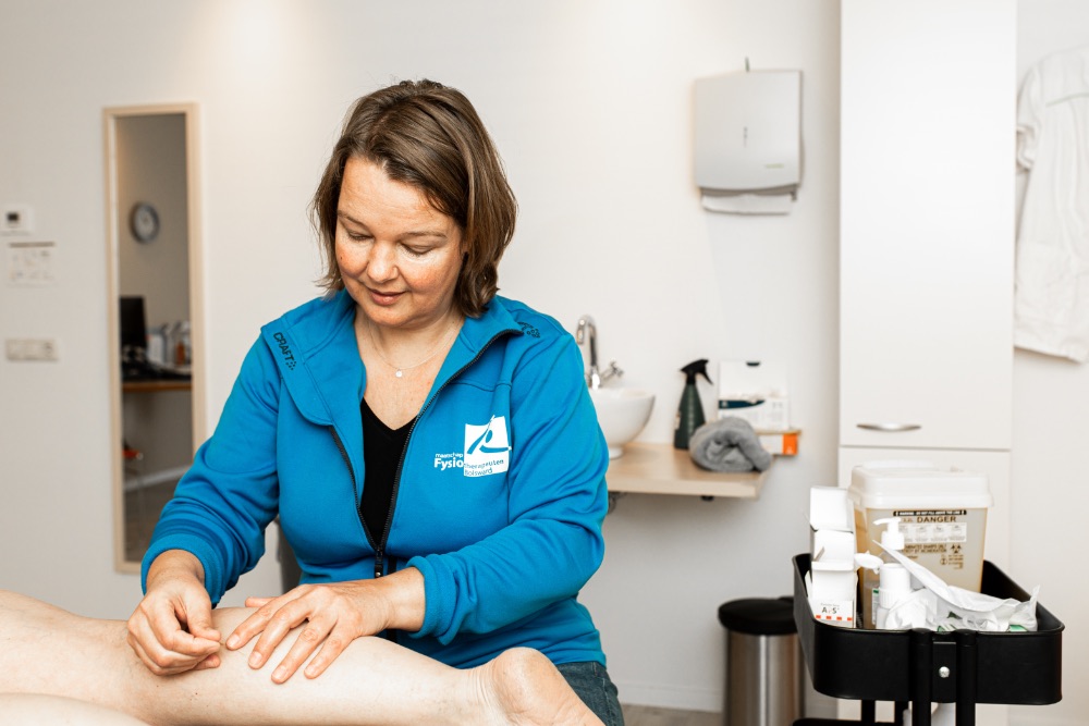 Een dry-needling behandeling op kuit